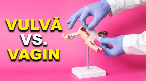 ce este vulva varicoasă